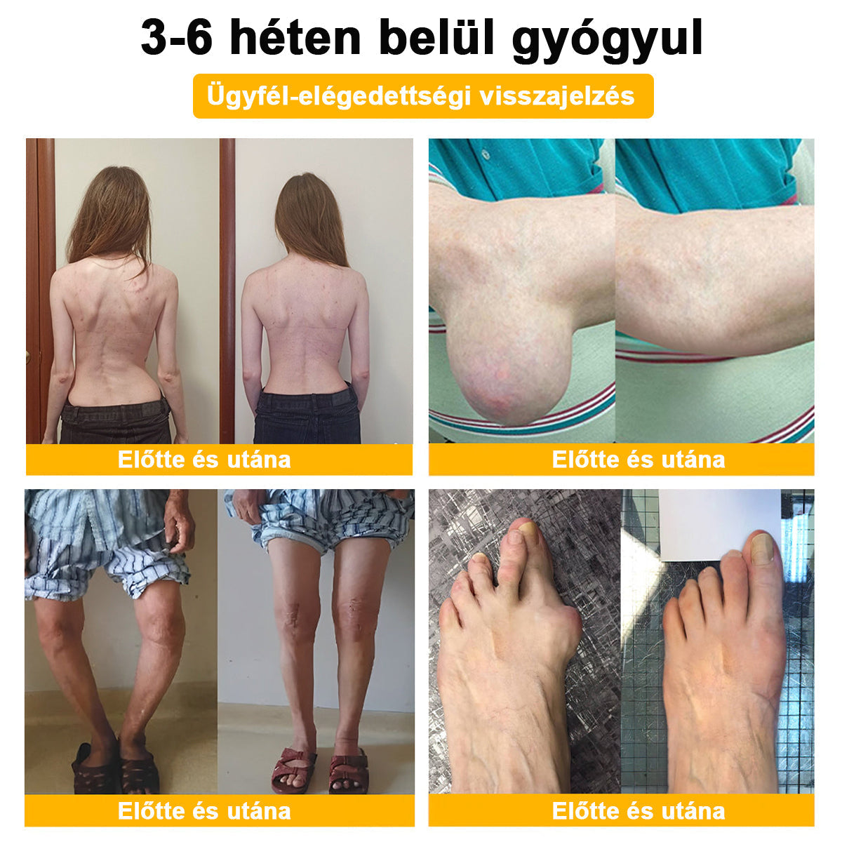 (Specjalnie dla osób starszych i zalecany przez AAOS) ArthroEase 🌱 Krem do leczenia zapalenia stawów z jadem pszczelim