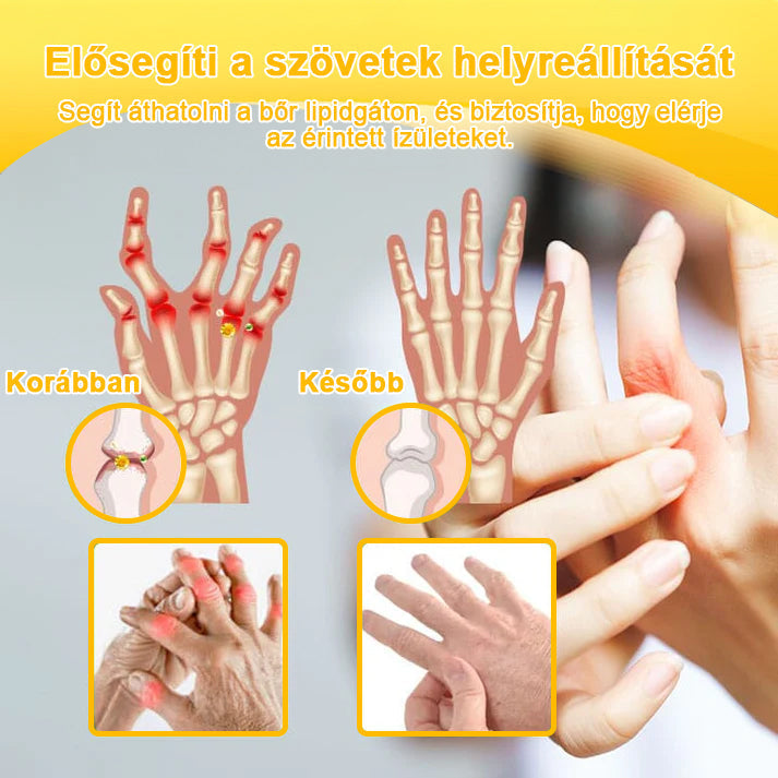 (Specjalnie dla osób starszych i zalecany przez AAOS) ArthroEase 🌱 Krem do leczenia zapalenia stawów z jadem pszczelim