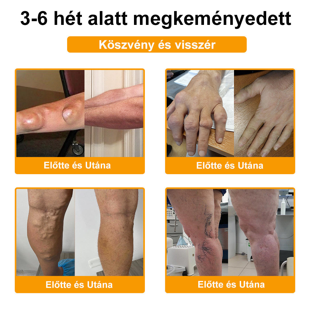 (Specjalnie dla osób starszych i zalecany przez AAOS) ArthroEase 🌱  Krem do leczenia zapalenia stawów z jadem pszczelim