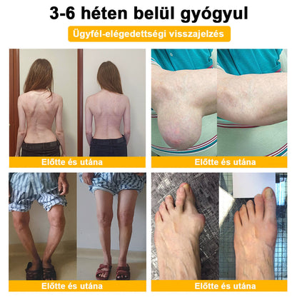 (Specjalnie dla osób starszych i zalecany przez AAOS) ArthroEase 🌱  Krem do leczenia zapalenia stawów z jadem pszczelim