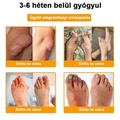 (Specjalnie dla osób starszych i zalecany przez AAOS) ArthroEase 🌱  Krem do leczenia zapalenia stawów z jadem pszczelim