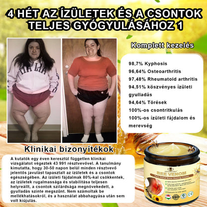 (Specjalnie dla osób starszych i zalecany przez AAOS) ArthroEase 🌱  Krem do leczenia zapalenia stawów z jadem pszczelim